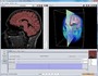 YaDiV - Yet another Dicom Viewer (main window)